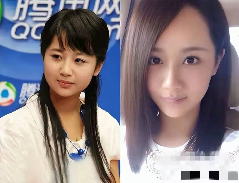 若两人」：一场关于美的技术革命与身份焦虑冰球突破爆百万大奖惊！女明星整容前后「判