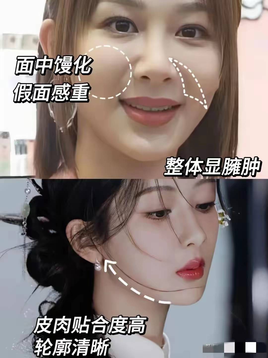 若两人」：一场关于美的技术革命与身份焦虑冰球突破爆百万大奖惊！女明星整容前后「判(图3)