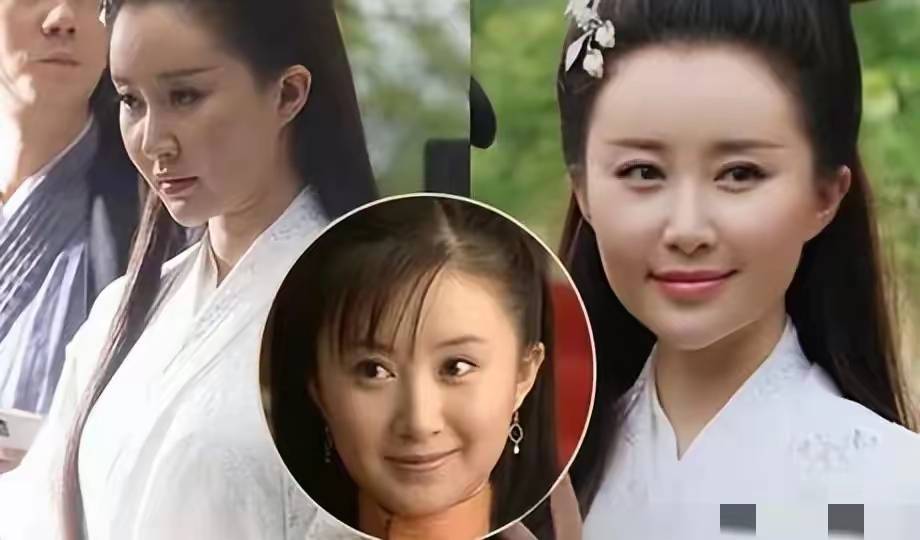 若两人」：一场关于美的技术革命与身份焦虑冰球突破爆百万大奖惊！女明星整容前后「判(图4)