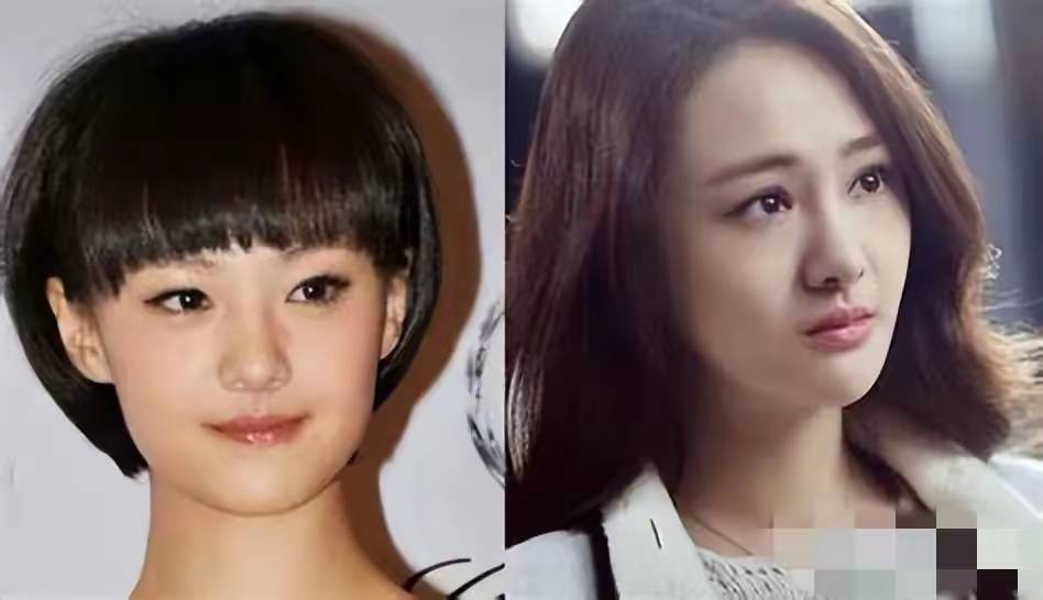 若两人」：一场关于美的技术革命与身份焦虑冰球突破爆百万大奖惊！女明星整容前后「判(图5)